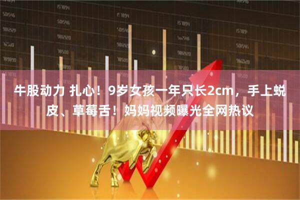 牛股动力 扎心！9岁女孩一年只长2cm，手上蜕皮、草莓舌！妈妈视频曝光全网热议